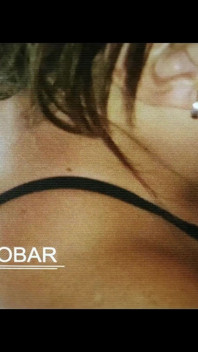 Büyük götlü Kolombiyalı albino cüce