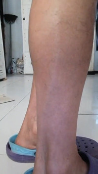 That Piernotas