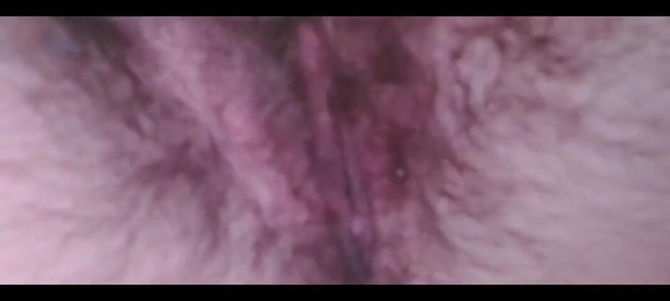 RavenHearth666VIP: Sepanjang malam – saya merasuk sesuatu yang gatal-gatal