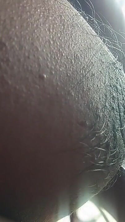 Armpit (Fapidontmind)