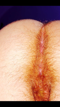 Hairy Butt of a 5-month Pregnant Woman