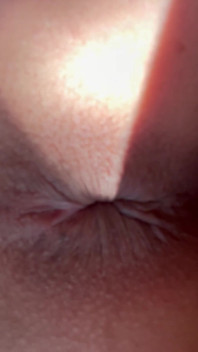 Sleepy Morning Hole