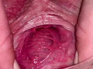 Pussy gaping