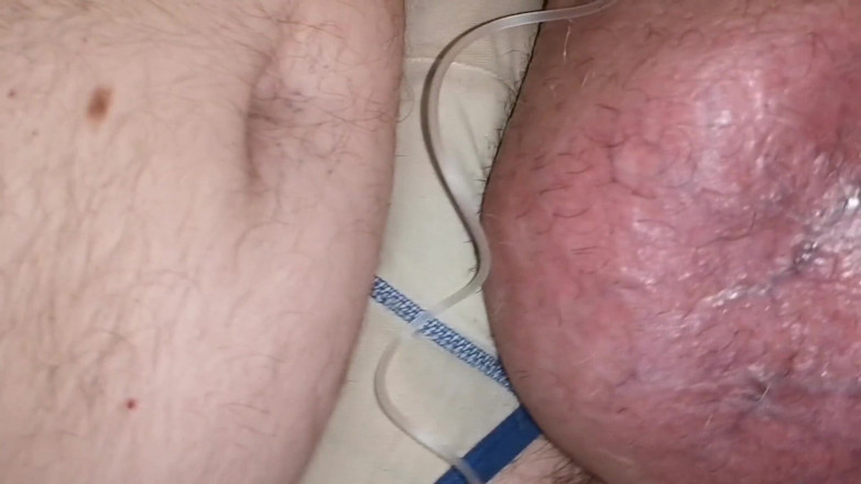 Monster_Meat_: Crecimiento masivo por glucosa