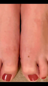 Toes Thursday