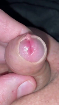 Playing with My Soft Small Cock Forskin
