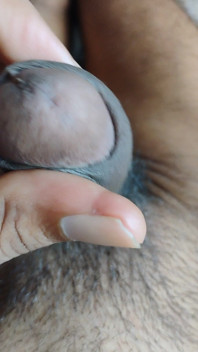 My Penis