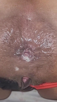 Trying to Get the Sperm Out, It Was so Deep That It Didn't Come Out