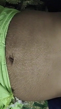 Femme mallu
