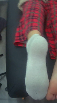 The Lollipop Had the Last Word… in Splashes