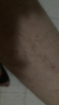 Myself Werner Kurpjuweit Naked Night Plus Legs Close-up