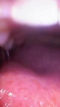 Au fond de la bouche de Sydney - Sydney Screams exhibe sa bouche, sa langue, sa gorge et sa uvule avec endoscope
