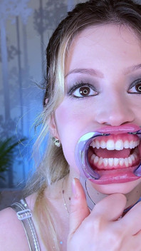 Esame dentale estremo fetish dei denti