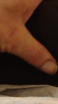 Teaser