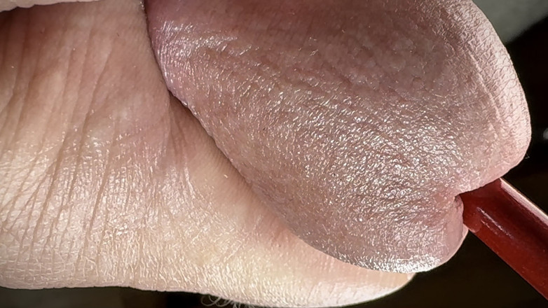 Leonardo-1974: Penis deliği birbirinden esneiyor