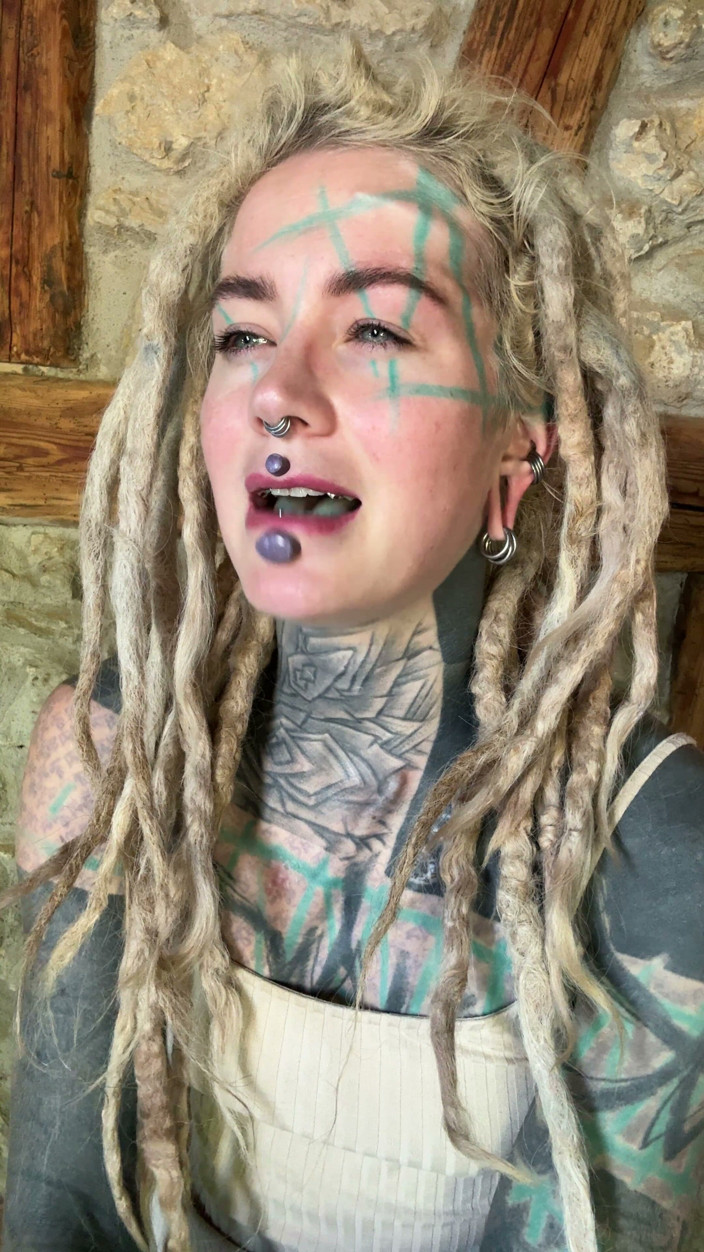 Anuskatzz: Vet Du Vad En Övre Blepharplasty Är?