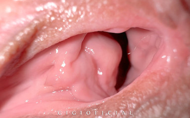 Gigi oficial: Ketika Kamu bekerja sebagai dokter kandungan dan klienmu muncrat karena...