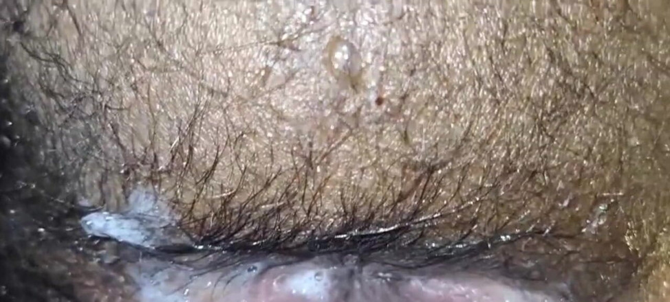 Babai: Bengali mông to rậm lông