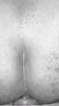 Sumbat Anal Ekstrem