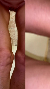 Drenagem De Esperma 6. Loira Deixa Gozar Fora De Sua Bunda Em Porção. Banho Solo!