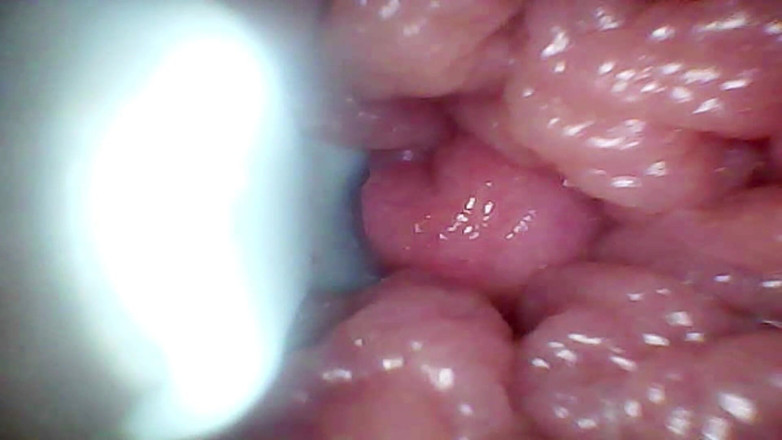 Ladybottox: Kamera Endoskopi Merekam G Spot Istriku. Video edukatif close up