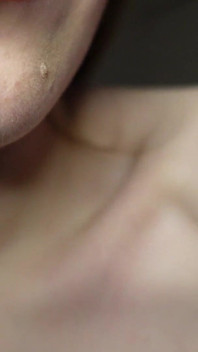 Eu Te Conto Sobre as Obturações Nos Meus Dentes E Visitas Odontológicas