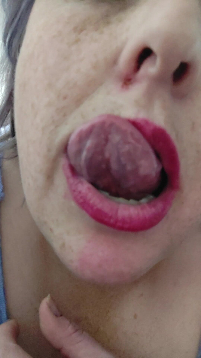 AngYourDirtyCanadian: Playing with My Tongue