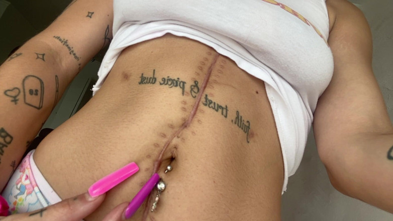 Nali Marie: Scar fetish belly button thắt lưng bụng gầy gò tuổi...