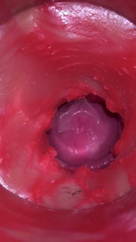 กล้องในหี: ทรงพลังแตกในหี! Asmr ภายในที่ดีที่สุด