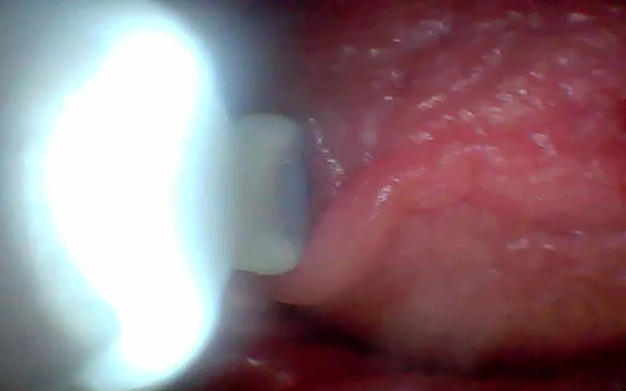 Twittiy: Endoscope Camera Shows the Most Sensitive Parts of the Penis...