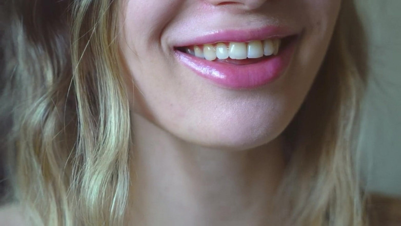 Rarible Diamond: Lipsihaa Vlastní