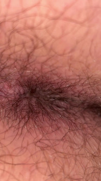Close up Hairy Hole