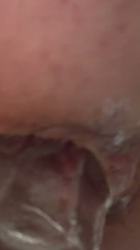 Stretching Out My Hole