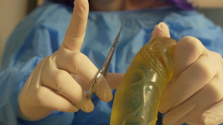 AmayaMori: Zlý doktor s tajemstvím obřezaný postup