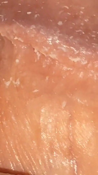 In a Doctor's Office I Apply Hot Glue to My Dick.