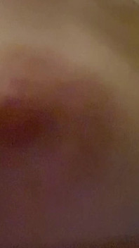 My Puffy Nipples Are Very Close
