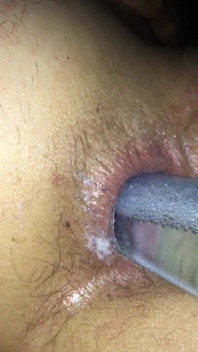 Anal Insertion