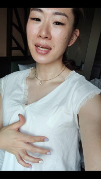 Day 3 Post Op