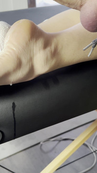 The Lollipop Couldn’t Handle the Pressure