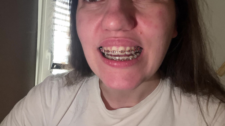 NicoleRay: Mit der Zunge die Zahnspangen lecken