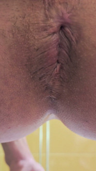 Teste de resistência extrema empurrando para um Rosebud - Extrema abertura anal!