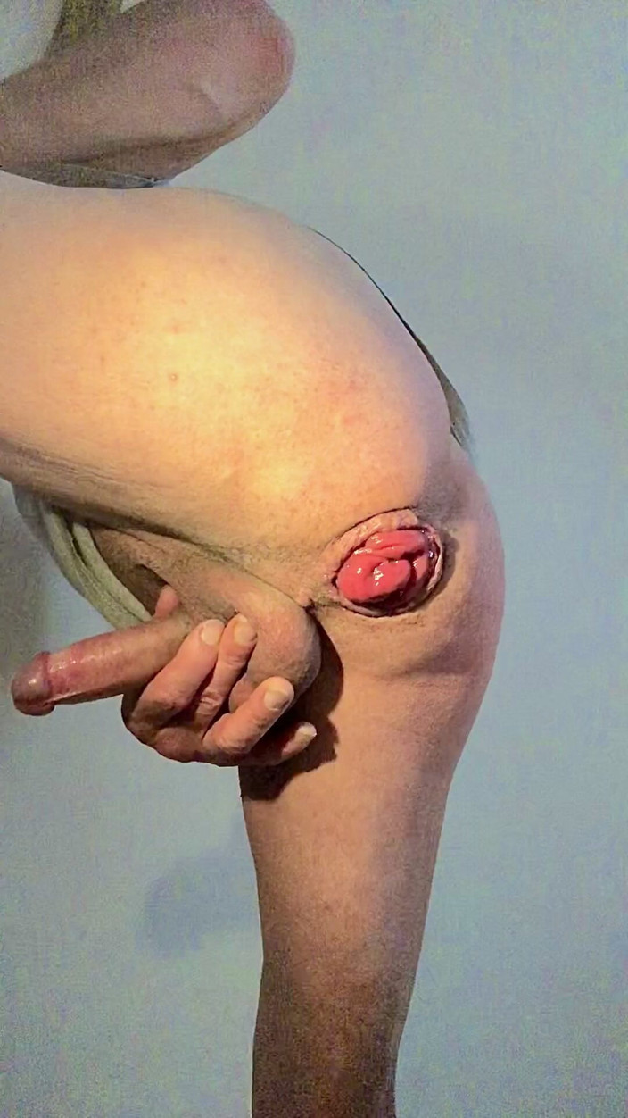 Jardinsecret346: Prolapsus anal
