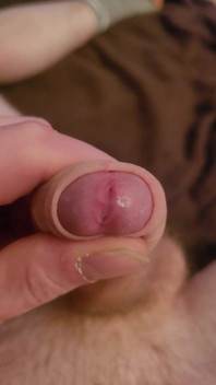 Penis Zeigen