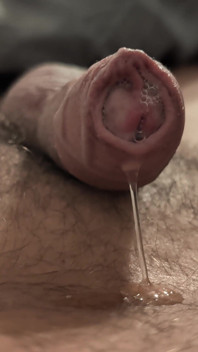 Il Mio Cazzo Non Circissicato Che Gocciola Desiderio