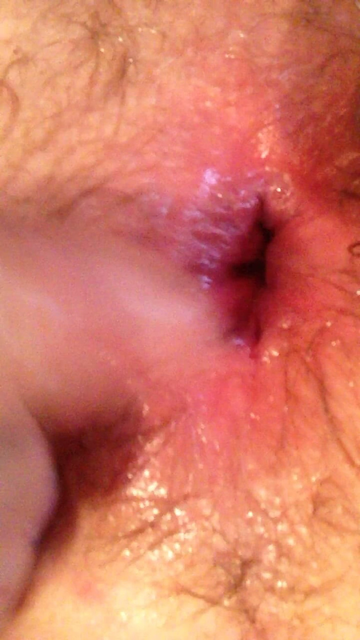 Jimmystar: Gaping My Virgin Hole