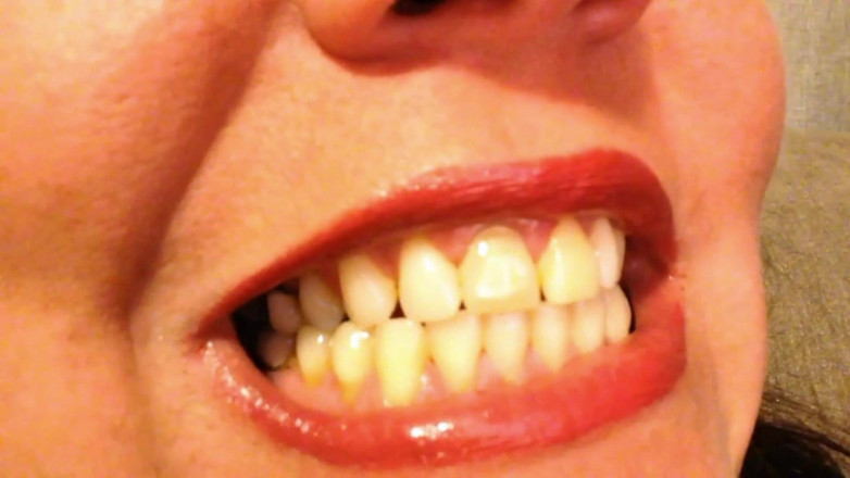 Lily Lipstixxx: Mouth inspection - Be careful, I bite!