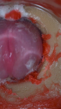 Insemination - Internal Camera Captures Deep Male Ejaculation