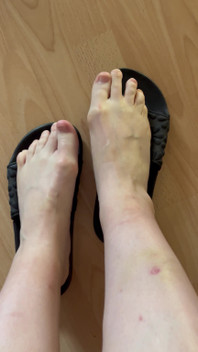 Feet in Flip-flops