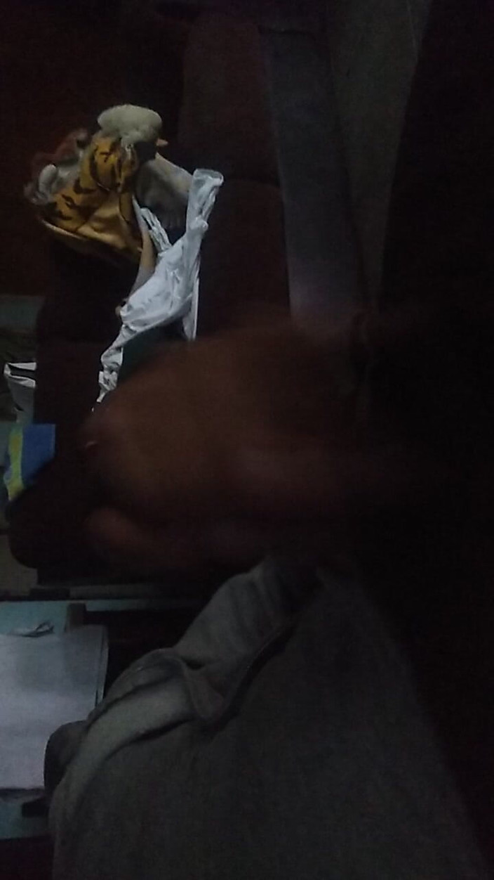 AlexAlejandro13: Regarde mon visage brûlant