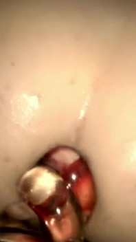 Glass in the Ass